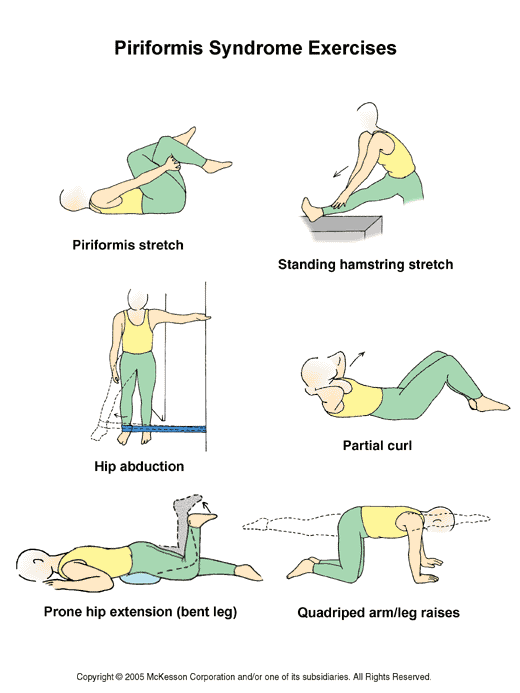 Piriformis Syndrome